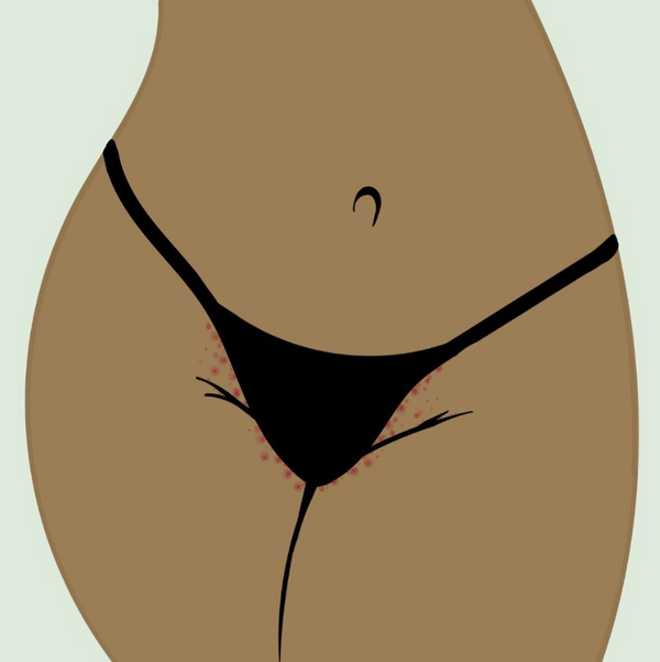 <p>Banish ingrown hairs and <br/>razor burn in just 3 easy steps</p>